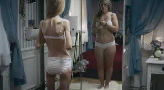 Anorexia e bulimia – O que são? 