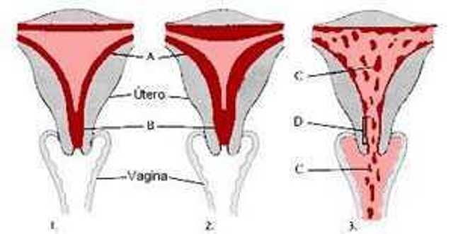 O que é a Menstruação?